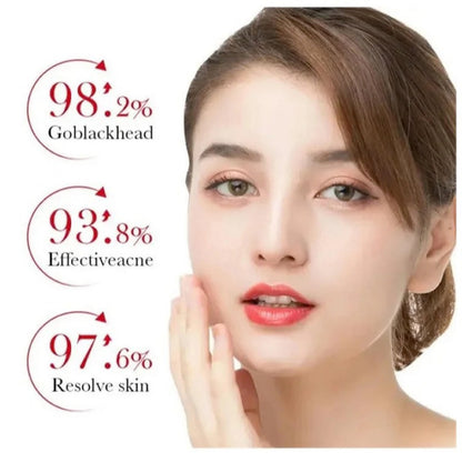 Bioaqua Salicylic Acid Acne Cream