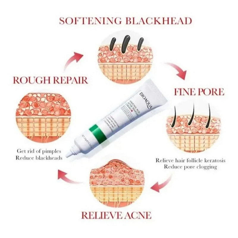 Bioaqua Salicylic Acid Acne Cream